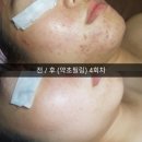 아리따운피부 이미지