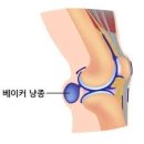 심베이커 네이버블로그
