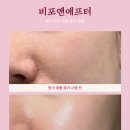 이벤트박스 이미지