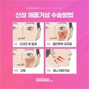 애플성형외과 네이버블로그