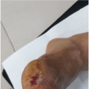 진주산소 티스토리