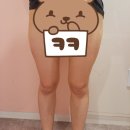 때빼멍 | 판교 허벅지 지방추출주사 달스주사 자세한 후기 feat.멍,통증,붓기,가격