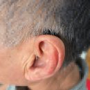 밀양시치매안심센터 | 밀양보청기 밀양서울보청기 삼문동에 거주하시는 60대 남성고객님, 보청기 상담후기입니다.