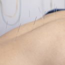 개봉한의원 이미지