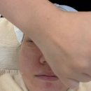 필아쿠아 | 세종피부관리샵 에스테틱 핸즈온유 아쿠아필 관리 후기