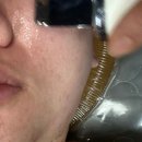 예쁜여우피부관리 | [경기/부천] 여우에스테틱 피부관리 후기 (트러블 피부관리)