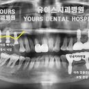 유어스치과병원 네이버블로그