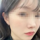 인천여드름한의원 하늘체한의원 인천여드름피부과 솔직후기