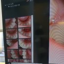 새늘치과의원 | 순천 [새늘치과] 인레이 가격 공유 ㅣ사랑니 발치상담+충치치료+스케일링 후기