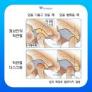 신세계 치과기공소 | 호치민 치과 : 13년차 치위생사의 스프린트 후기