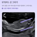 선천가설 | [성장기록 ⑤] 임신 16주차 2차 기형아 검사 | 젠더리빌 아기 성별 확인 후기