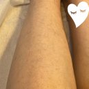[군산 지움뷰티] 군산왁싱샵 다리 전체 왁싱 솔직 후기｜군산왁싱잘하는곳 추천