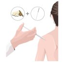 곽희준한의원 네이버블로그