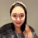 볼륨 | 선릉역피부과 티타늄리프팅 쥬베룩 볼륨 후기