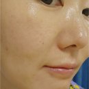 금강헬스케어 | 얼굴 라인 관리 &amp; 림프 순환! 스킨엠에잇 에너지 세럼 솔직 후기