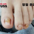 레푸스 사상점 이미지