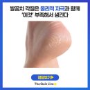 발꿈치 각질 제거 이미지