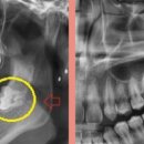 CW-2095-01 이미지