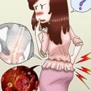 자궁경부암 초기증상 3가지 허리골반통증 원인 이미지