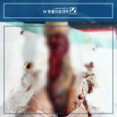 경남동물병원 | 강아지 화상 피부 결손 치료 가능할까 부산 경남 w동물병원 피부 치료 후기
