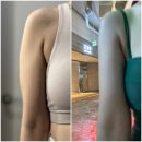 (주)하울팟케어클럽 | 팔뚝 부자탈출기 6!! 팔뚝 무한람스 후기 (효과,부작용)오렌지케어후관리에 대해서