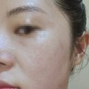 [삼척 에스테틱] 예비 신부 찐 추천! 웨딩 케어 맛집, 루가에스테틱 후기
