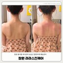 아르드뽀스킨케어&바디 | 창원피부관리실 라라스킨케어 테라노바 바디관리 등관리 후기