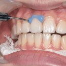 서울언제나치과의원 이미지