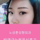 노상훈성형외과의원 | [논현역/노상훈성형외과] 눈썹문신이벤트! 강남에서 반영구눈썹문신하고 온 후기