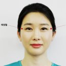 [촌철지압] &#39;태양혈&#39; -두통 등에 / 송미연 진료과장 이미지