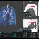 라인소프트 이미지