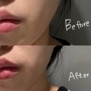[리뷰] 보다나 뷰티 스킨 바운스 엠에스원 + 듀얼 이펙트 부스팅 젤 후기 (보다나괄사 / 바디괄사)