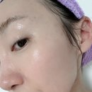 NP 컨디셔닝 네이버블로그