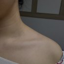 피콘 ems 마사지기 승모근,목,근막마사지 후기