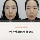 뮬피부과의원 이미지