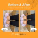 신진주 | [신진주필라테스] 오렌지필라테스 개인레슨 후기🍊 골반 비대칭 개선 Before & After ✨