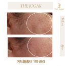 더조각테라피 이미지
