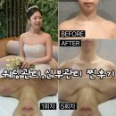 결혼식 1개월 전에 관리샵 바꾸고 광명찾은 후기 &lt;뷰티앤슬림&gt;
