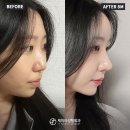 제이티성형외과의원 이미지