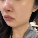 퍼피파우더룸 | [잠실 에스테틱] '스킨앤유 잠실' 슬림 디톡스 림핏 및 데콜테 신부관리 솔직 후기