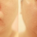 수원 망포 피부관리 에스테틱 다리아 셀럽 리프팅 후기 비대칭 얼굴 이중턱 윤곽관리 한 번에!