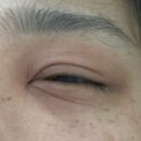 장지철치과의원 | 세븐틴은 나나투어? 김냥이는 병원 투어!