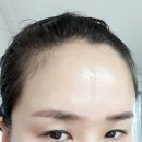 울트라브이 신제품 바이오BF앰플 사용후기 : 후케어앰플