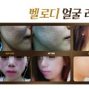 소향피부관리