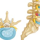 바른자세척추운동(SNPE)2 이미지