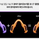 리온 메디 이미지