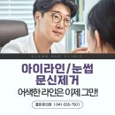천안눈썹문신제거 어색한 라인은 지우고 자연스럽게 복원하세요
