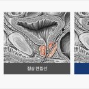 서울수비뇨의학과의원 이미지