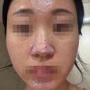 로즈힙 | 아렌시아 떡솝 클렌저 로즈힙 수부지 후기 (사용방법, 블랙헤드)