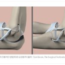 투수의 팔과 어깨 부상(총정리) 이미지